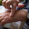 kako prepoznati artritis