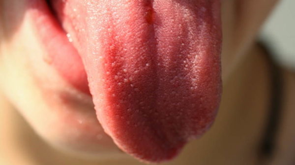 bolan jezik