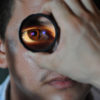 Oštećenje vida - Bolesti očiju
